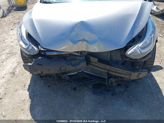 Hyundai dohc mpi nu 2016 5NPDH4AE7GH728066 Image 6