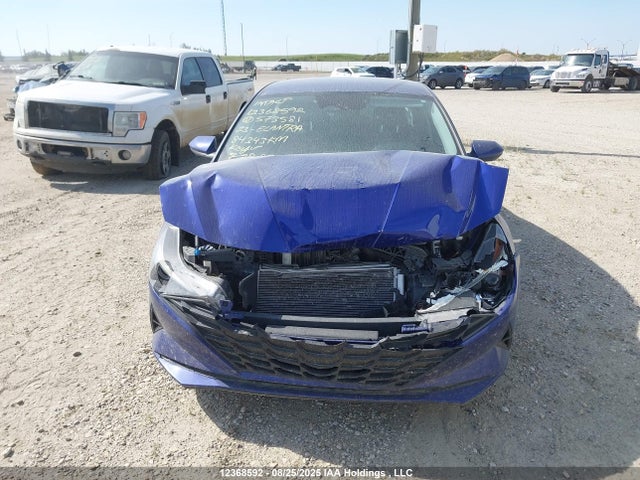 KMHLM4AG0PU573581 Hyundai mpi nu pe
