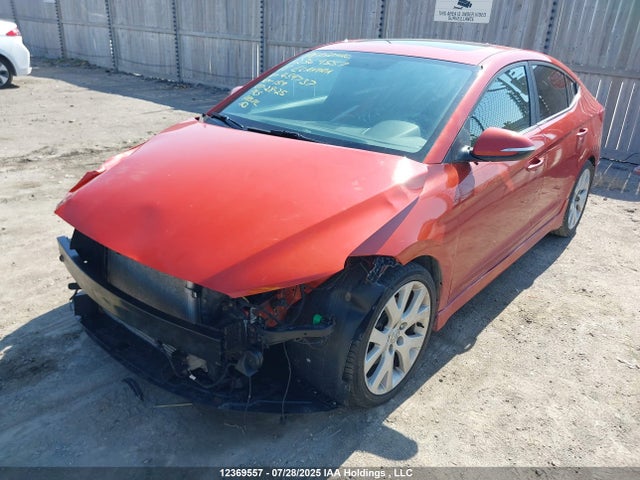 KMHD04LB4JU459737 Hyundai g 1.6 dohc t-gdi