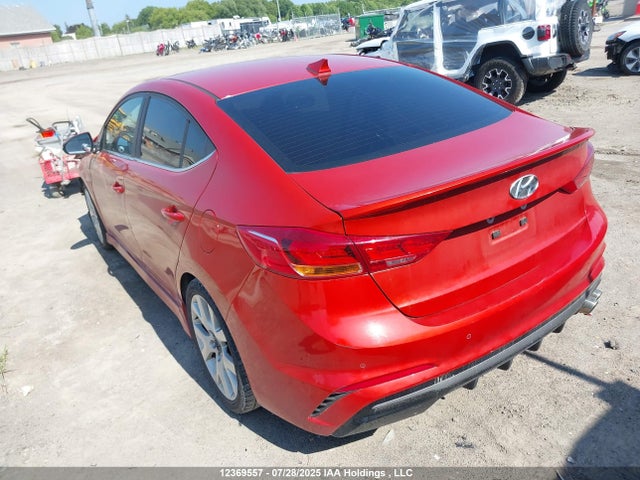 KMHD04LB4JU459737 Hyundai g 1.6 dohc t-gdi