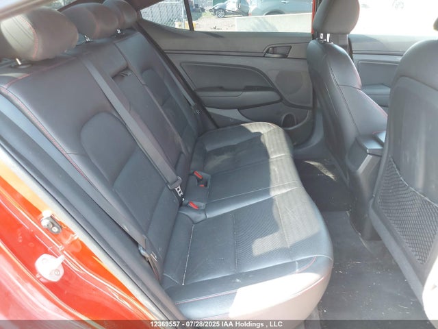 KMHD04LB4JU459737 Hyundai g 1.6 dohc t-gdi