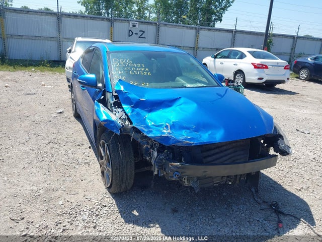 KMHD84LF2JU651556 Hyundai mpi nu