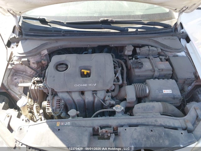 KMHD84LF6HU186290 Hyundai 2017