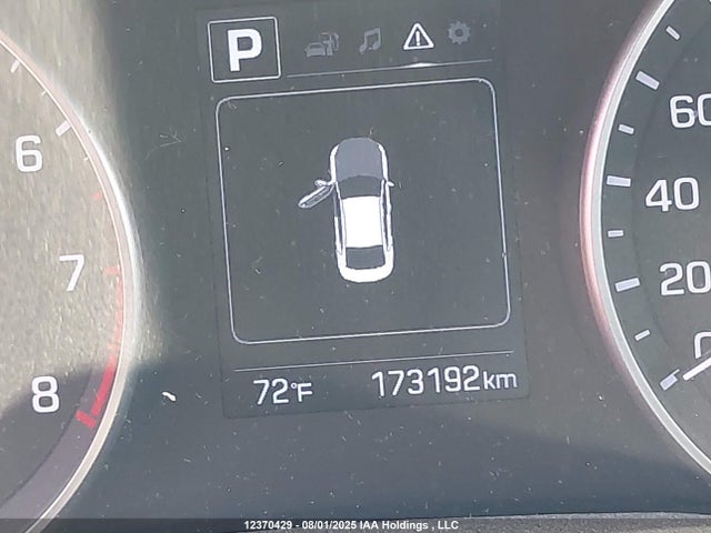 KMHD84LF6HU186290 Hyundai 2017