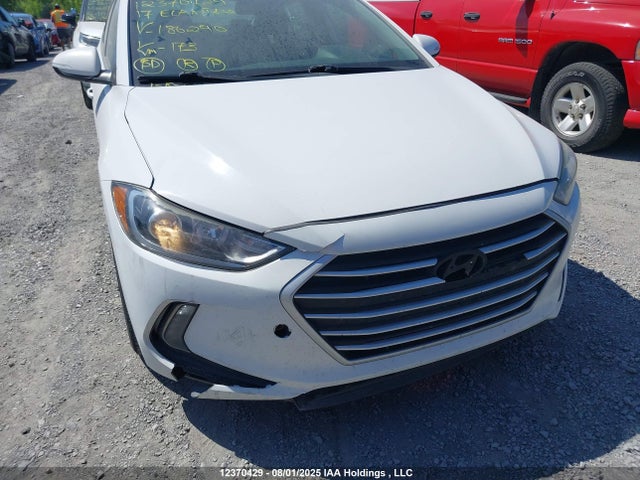 KMHD84LF6HU186290 Hyundai 2017