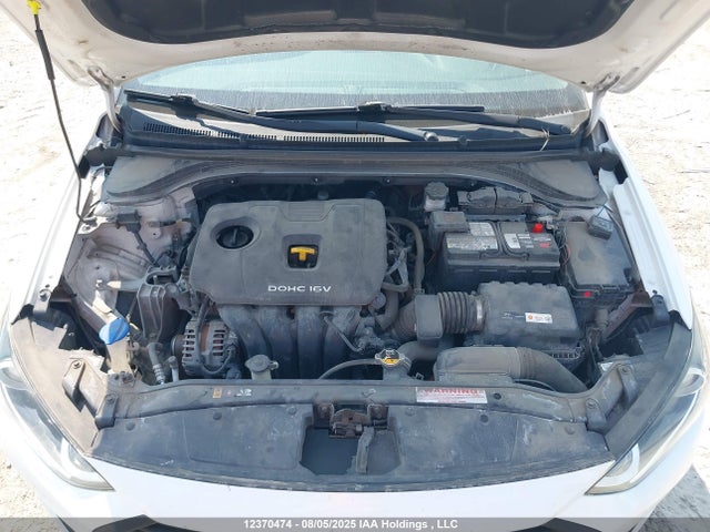 KMHD84LF2HU380993 Hyundai 2017