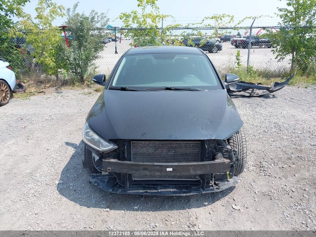 KMHD84LFXJU633290 Hyundai mpi nu