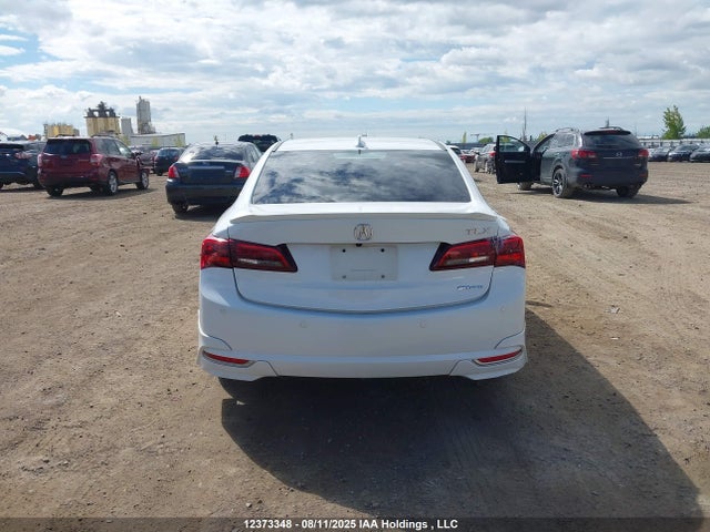 Acura j35y6 2017 19UUB3F78HA801414 Image 17