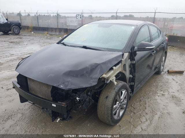 KMHD84LF5JU635156 Hyundai mpi nu