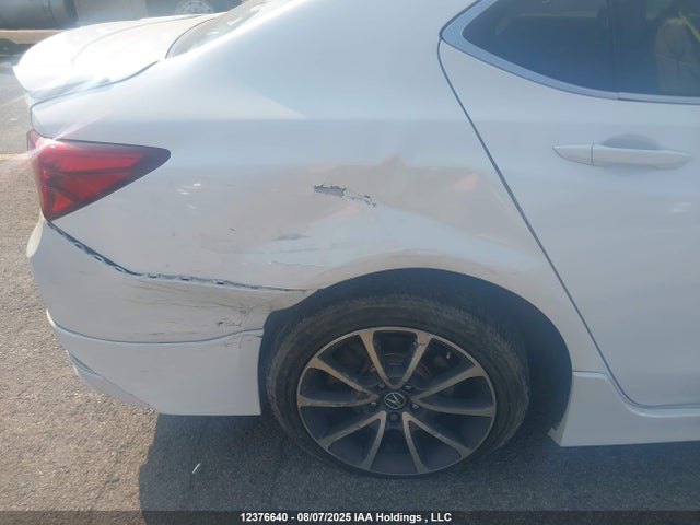 Acura j35y6 2015 19UUB3F35FA803003 Image 6