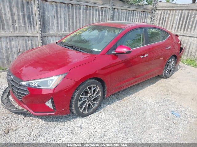 KMHD84LF1LU003791 Hyundai mpi nu