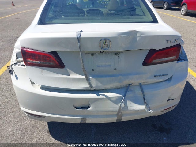 Acura j35y6 2015 19UUB3F52FA801307 Image 6