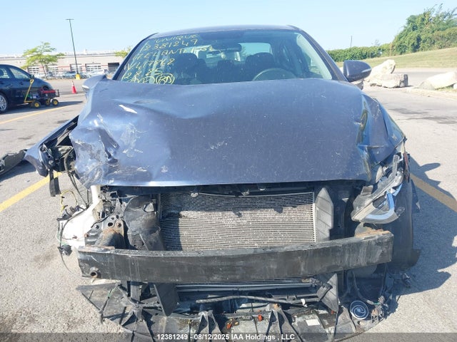 KMHD84LF9HU417862 Hyundai Elantra