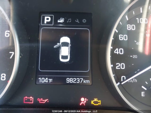 KMHD84LF9HU417862 Hyundai Elantra