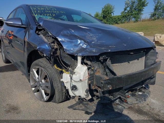 KMHD84LF9HU417862 Hyundai Elantra