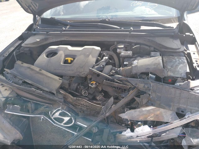 KMHD84LF9LU911647 Hyundai mpi nu