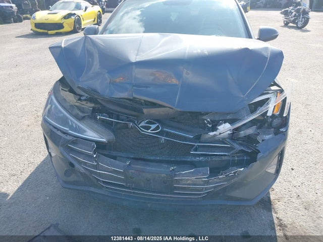 KMHD84LF9LU911647 Hyundai mpi nu