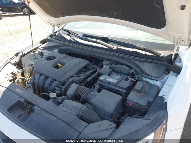 KMHD84LF1LU936140 Hyundai mpi nu