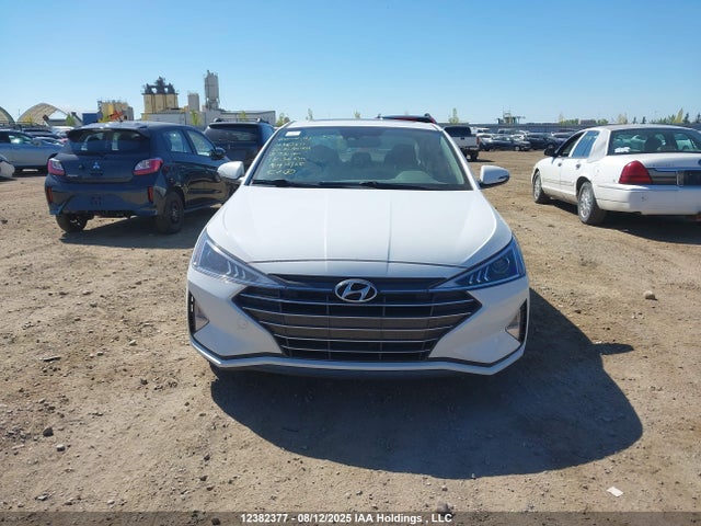 KMHD84LF1LU936140 Hyundai mpi nu