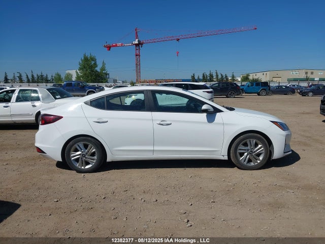 KMHD84LF1LU936140 Hyundai mpi nu