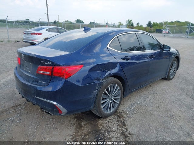 Acura j35y6 2019 19UUB3F50KA801834 Image 4