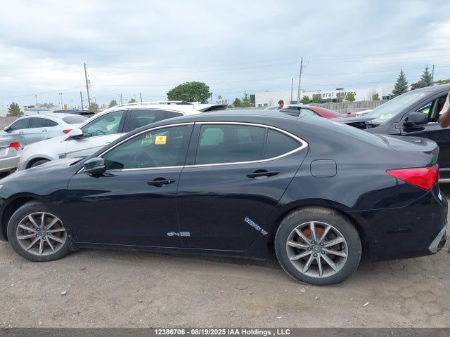 19UUB1F53JA800597 Acura k24w7