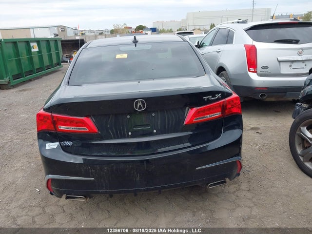 19UUB1F53JA800597 Acura k24w7