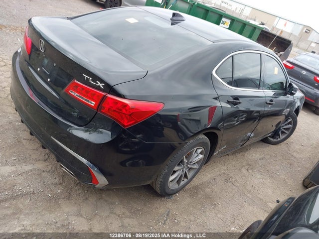 19UUB1F53JA800597 Acura k24w7