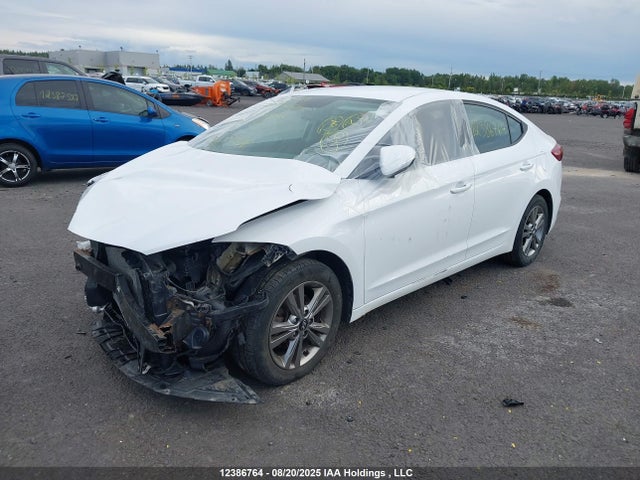 KMHD84LF5JU635111 Hyundai mpi nu