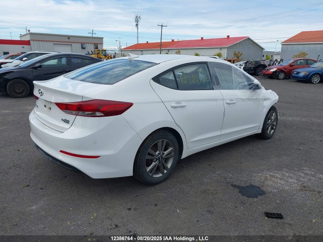 KMHD84LF5JU635111 Hyundai mpi nu