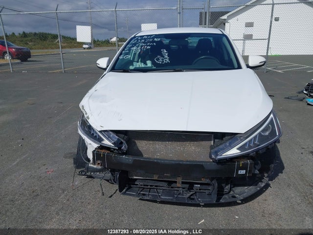 KMHD84LFXLU086198 Hyundai mpi nu