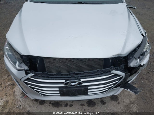 KMHD84LF4JU672862 Hyundai mpi nu