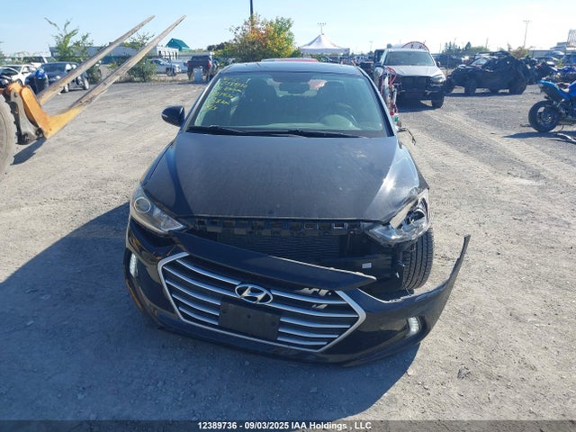 KMHD84LF2JU697436 Hyundai mpi nu