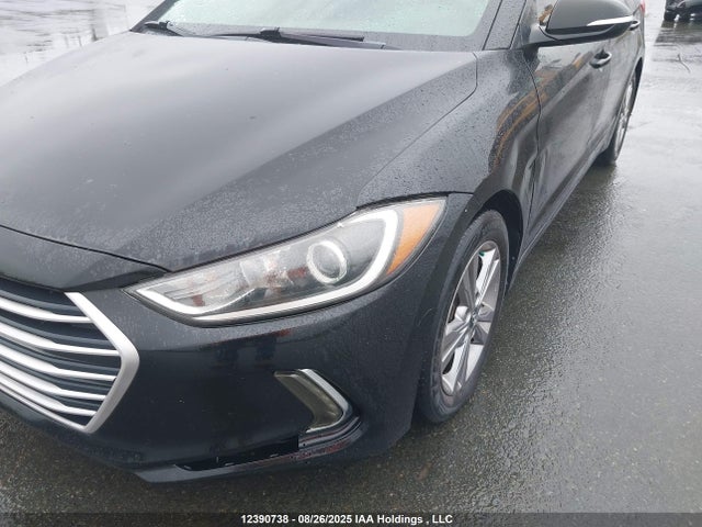 KMHD84LFXHU336580 Hyundai ELANTRA GL