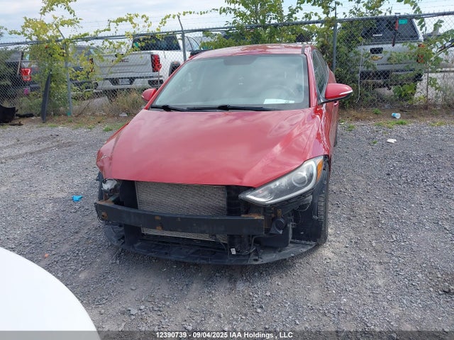 KMHD84LF1JU636028 Hyundai mpi nu