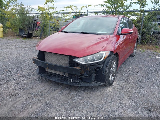 KMHD84LF1JU636028 Hyundai mpi nu