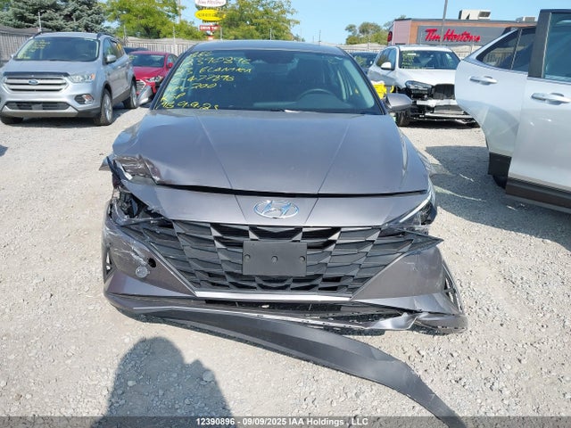 KMHLM4AG5PU477896 Hyundai mpi nu pe