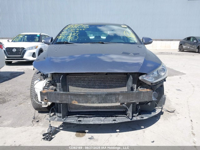 KMHD84LF5JU484755 Hyundai mpi nu
