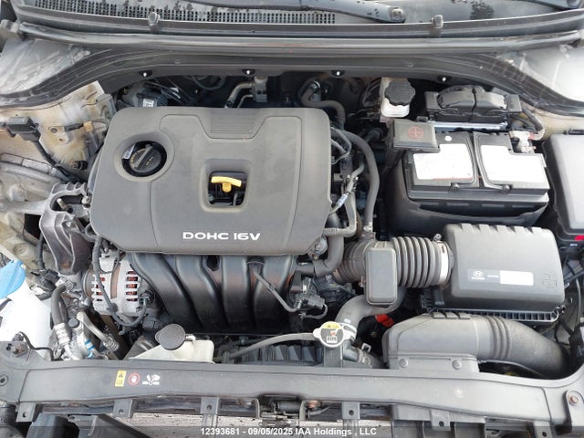 KMHD84LF0HU390082 Hyundai 2017
