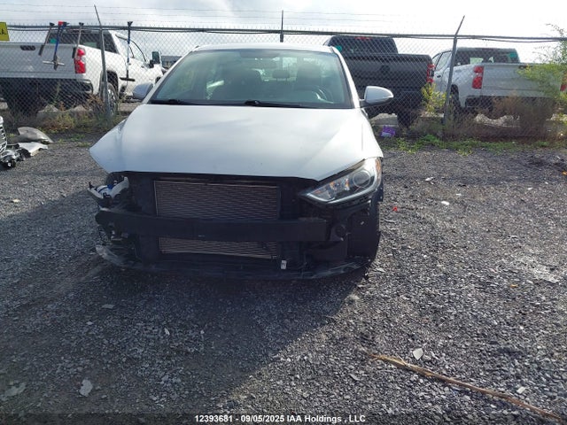 KMHD84LF0HU390082 Hyundai 2017