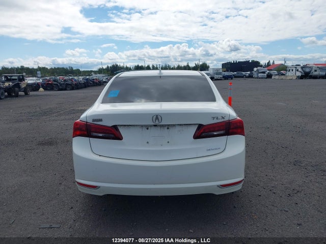 19UUB3F51HA801544 Acura j35y6
