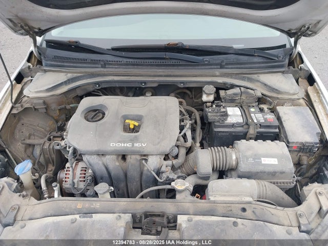 KMHD84LFXHU193372 Hyundai Elantra