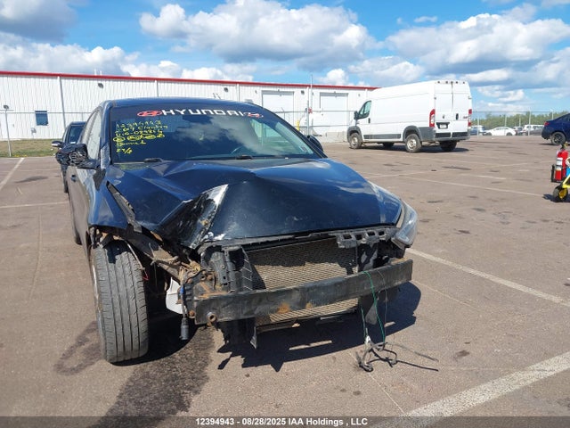 KMHD84LF4HU089864 Hyundai Elantra