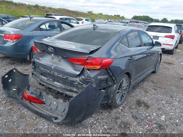 KMHD04LB8JU514898 Hyundai g 1.6 dohc t-gdi