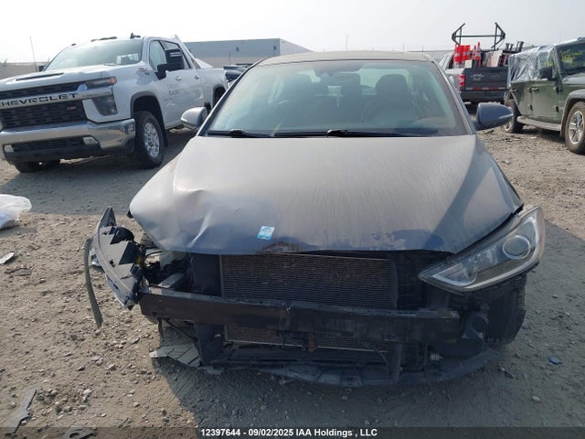 KMHD84LF2HU172970 Hyundai Elantra