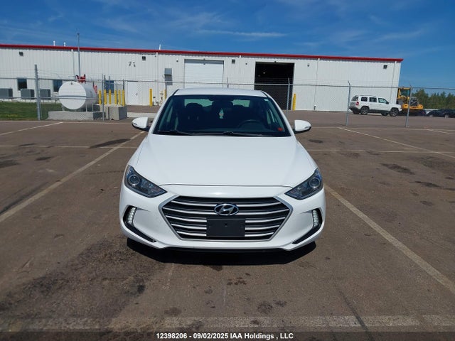 KMHD84LF3HU244534 Hyundai Elantra