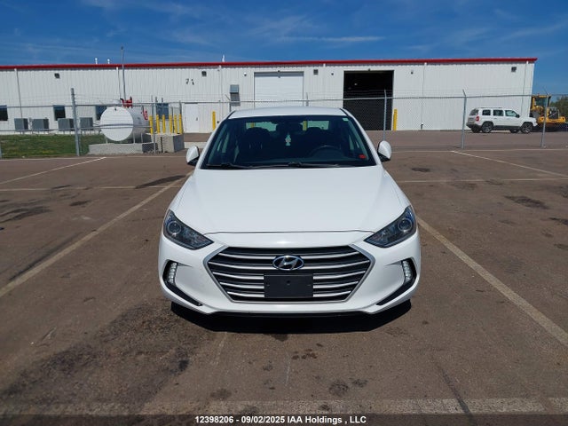 KMHD84LF3HU244534 Hyundai Elantra