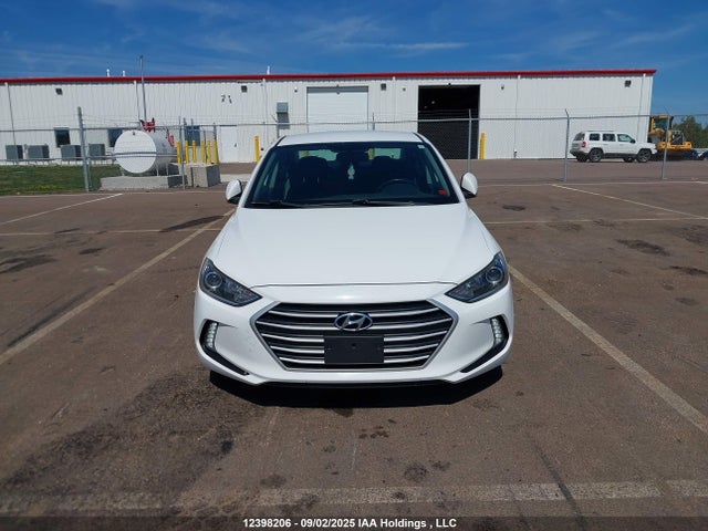 KMHD84LF3HU244534 Hyundai Elantra