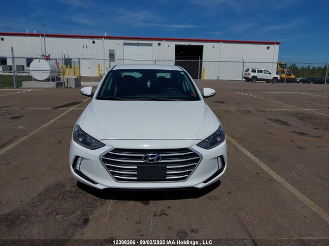 KMHD84LF3HU244534 Hyundai Elantra