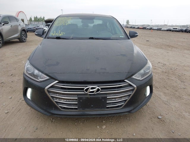 KMHD84LF9HU104777 Hyundai 2017
